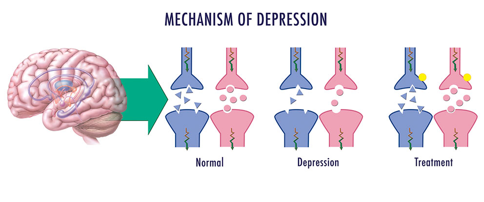 Happy Or SAD The Chemistry Behind Depression