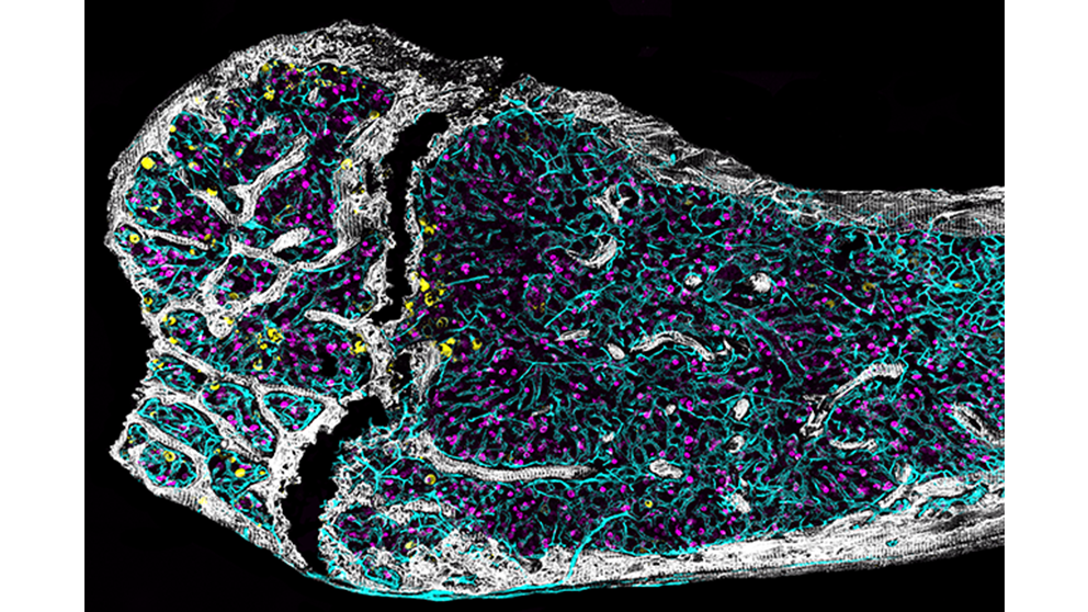 An image of a cross-section of a bone taken from the lab of The Jackson Laboratory's Jennifer Trowbridge.